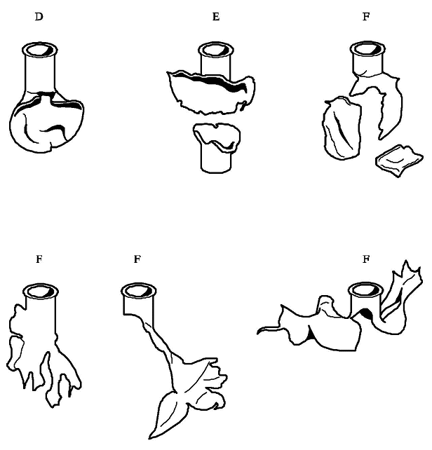Ｄ，Ｅ，及びＦの結果の例